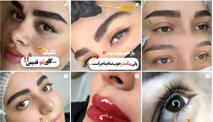 مرکز فیبروز ابرو سمانه نجفی قم