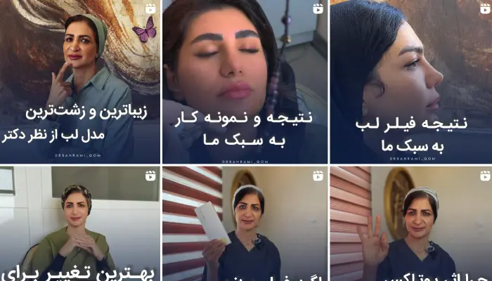 کلینیک ژل لب دکتر بهرامی قم