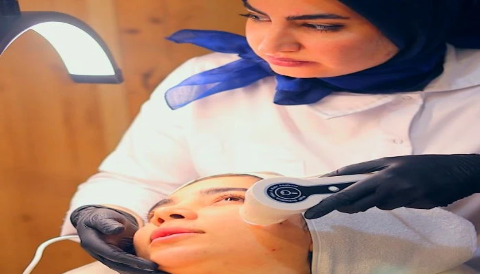 فیشیال پوست آلما