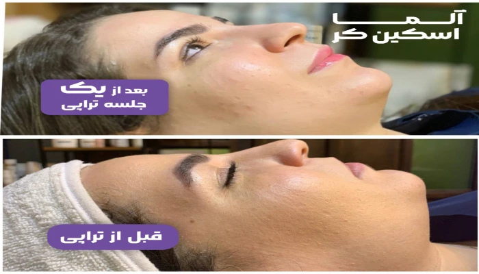 مرکز تخصصی پاکسازی پوست آلما