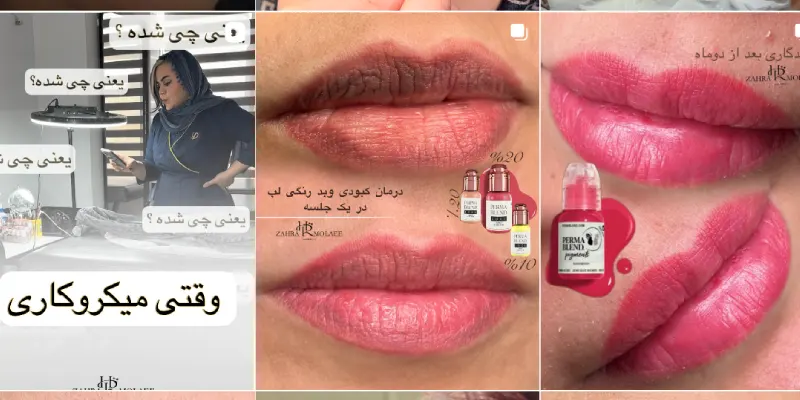 شیدینگ لب زهرا مولایی در قم
